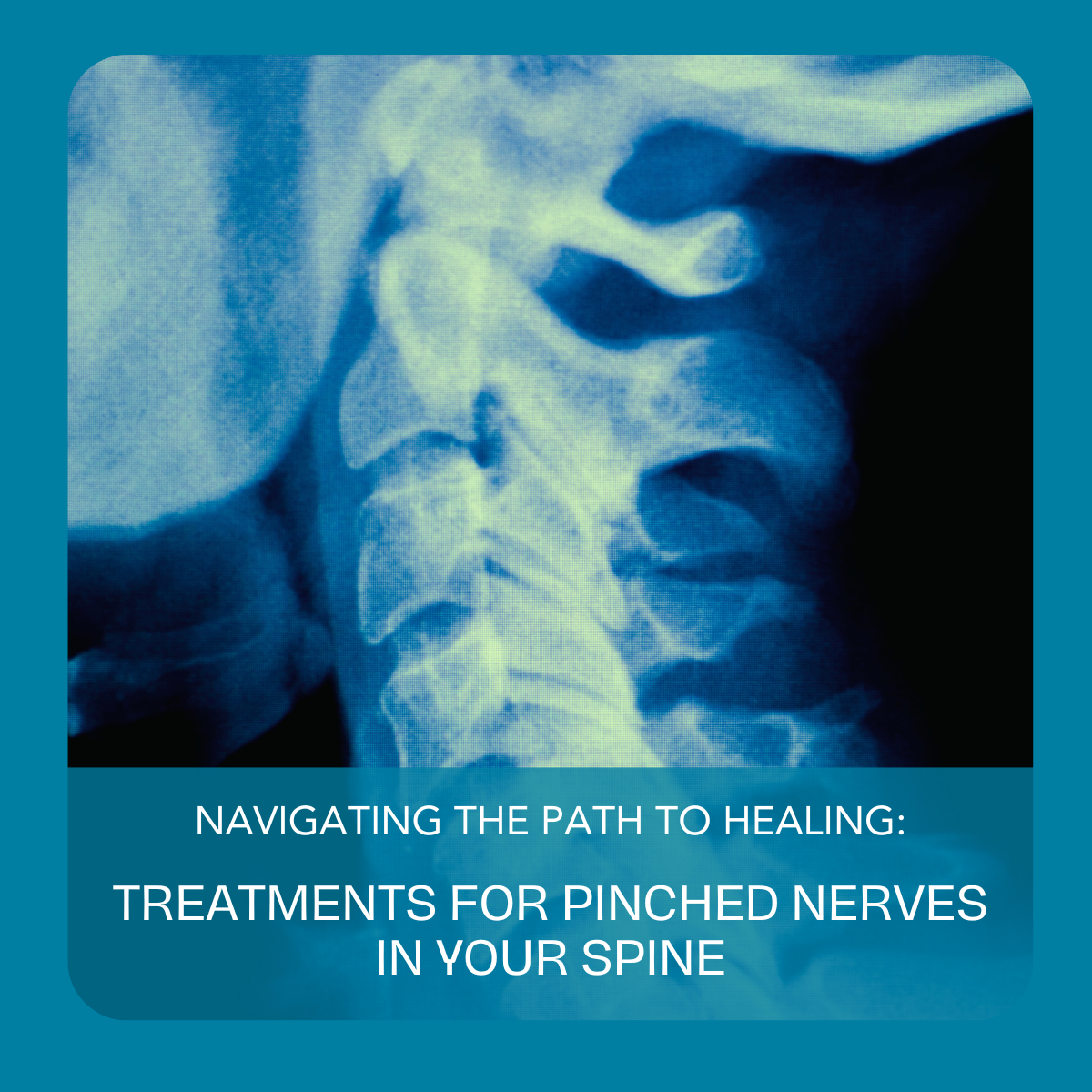 Treatments for Pinched Spinal Nerves Diagnosis and Spinal Treatment