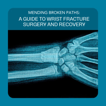 Mending Broken Paths: A Guide to Wrist Fracture Surgery and Recovery-Learn about wrist fracture surgery recovery and tips for speedier healing