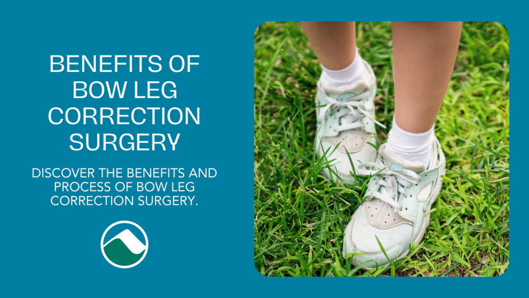 Teal background with the title "Benefits of Bow Leg Correction Surgery: Discover the benefits and process of bow leg correction surgery." The image shows a close-up of a child's legs and feet standing on grass, wearing white sneakers and socks. The Monadnock Community Hospital logo is at the bottom.
