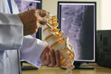 A doctor holding a model of a spine, explaining treatment options, highlighting access to orthopaedic surgery specialists at MCH