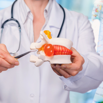 A doctor wearing a white coat and stethoscope holds a detailed model of a spinal vertebra with a herniated disc. The model is being pointed to with a medical instrument, illustrating the affected area. The background is blurred to focus attention on the model and the doctor’s hands.